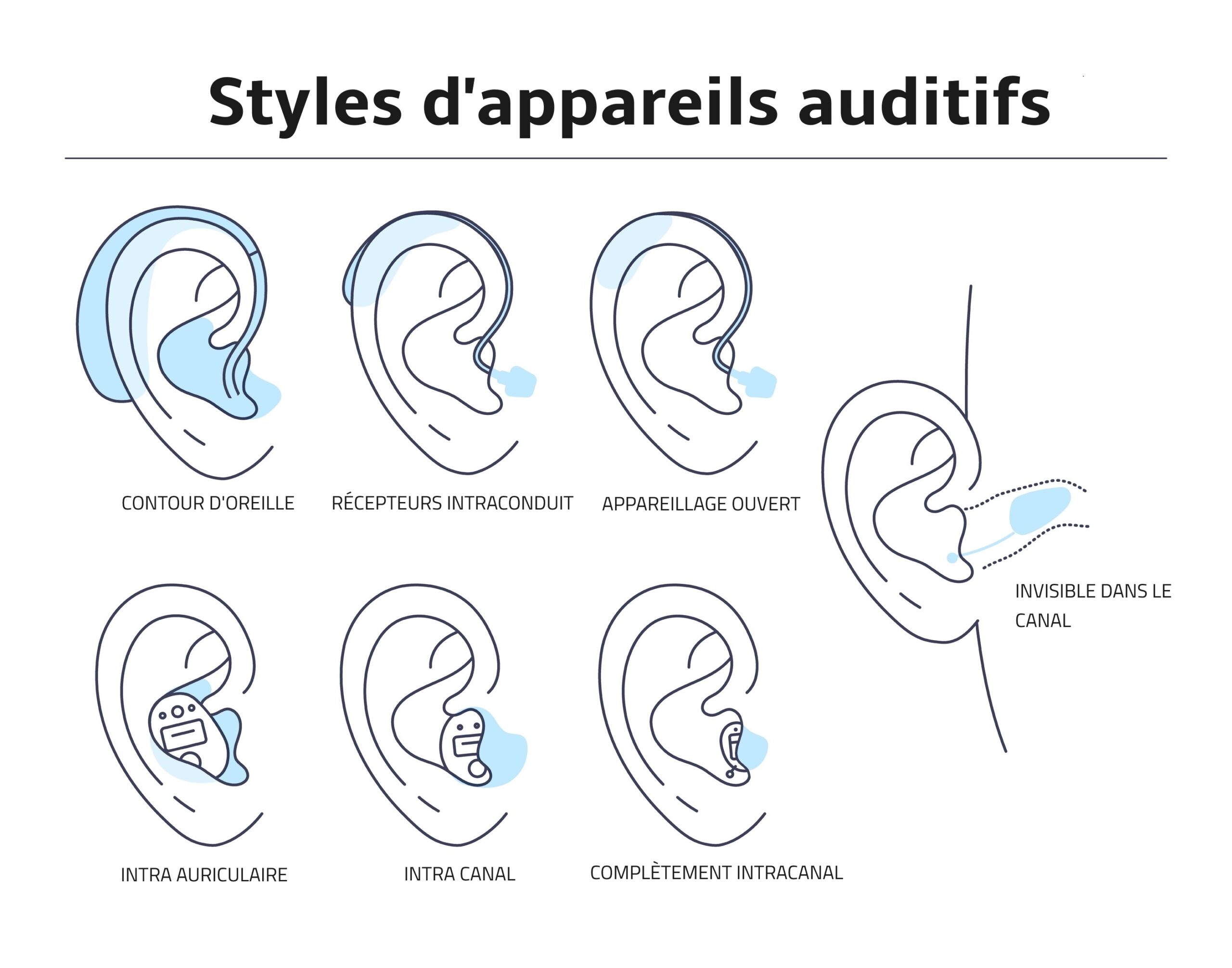 Types,Of,Hearing,Aids,For,The,Hearing,Impaired,And,The